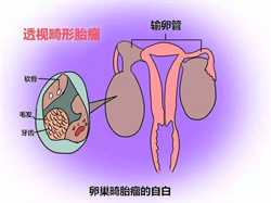 湖南代孕医疗器级:胎膜和胎盘的区别是什么