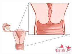 衡水代孕网的流程:代孕有卵巢囊肿正常吗