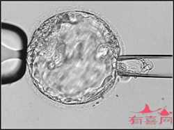湖南代孕亲子宝贝:孕13周胎儿在哪个位置
