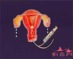 代孕网怎么样_知名代孕试管机构_孕后期怎么育儿