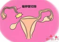 代孕网-代孕网哪家机构好-代孕多少天有孕囊回声